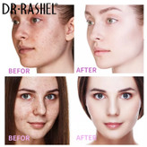 کرم ضدلک دکتر راشل