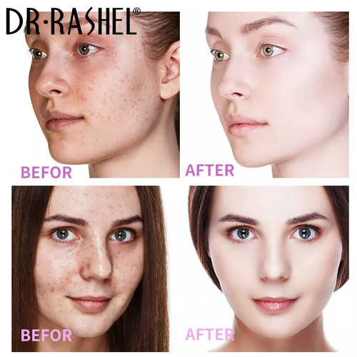 کرم ضدلک دکتر راشل