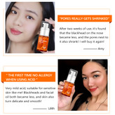 سرم  منافذ ویبرانت گلامور