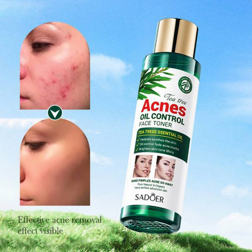 تونر ضد جوش چای سبز