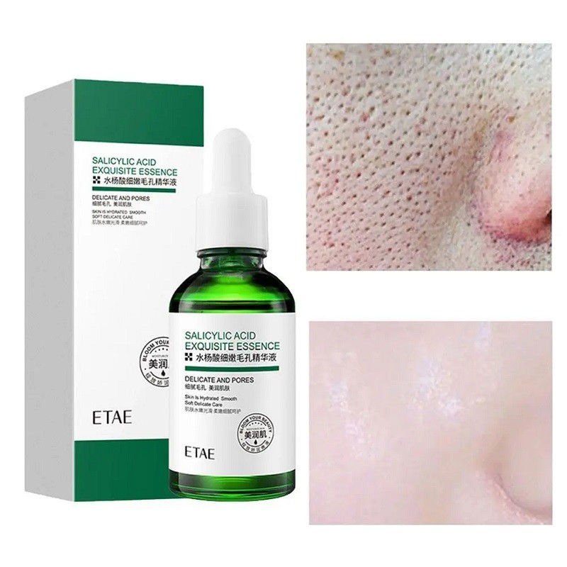 salicylic acid exquisite essence ETAE