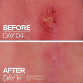 کرم ترمیم کننده سیکاپلاست پوست خشک و آسیب دیده لاروش پوزای اورجیناال