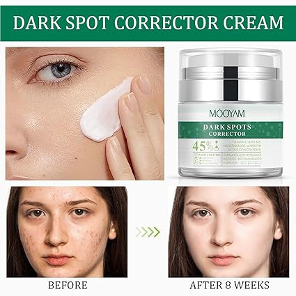 MOOYAM DARK SPOTS CORRECTOR