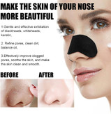 mask sadoer deep cleansing nose strips