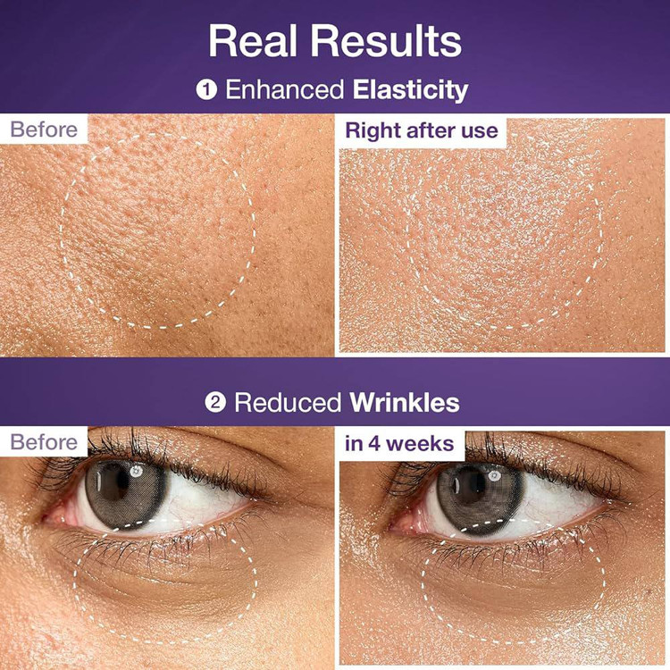 خرید سرم لیفتینگ