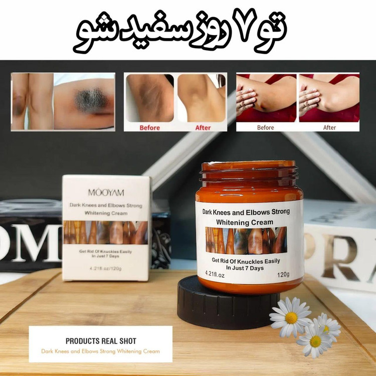 کرم سفید کننده قوی زانو و آرنج مویام MOOYAM