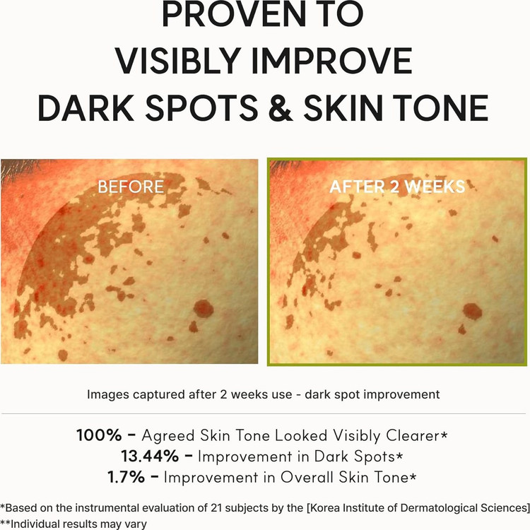 کرم روشنکننده صورت آرنسیا مدل Vitamin C Booster Shot مناسب برای انواع پوست حجم 30 میلیلیتر